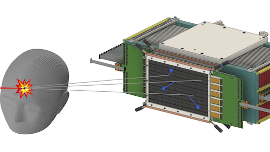 Proton beam irradiating a patient creating secondaries detected by a digital tracking calorimeter